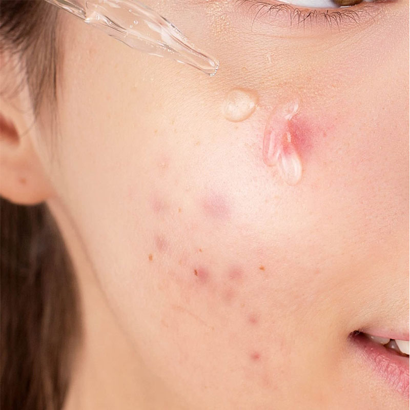 CARE:NEL Dr.Skin Niacinamide Zinc Serum 30ml