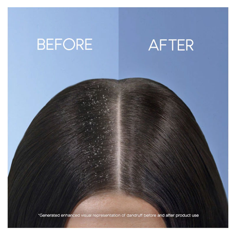 Head & Shoulders Daily Protect Anti - Dandruff Shampoo 475ml