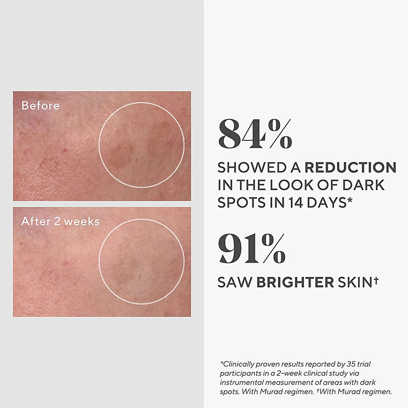 Murad Rapid Dark Spot Correcting Serum 10ml